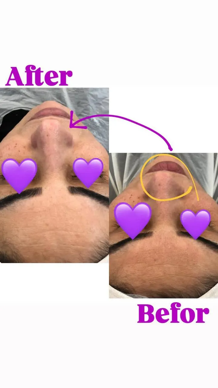 مریم اسکین‌کر - Image 2