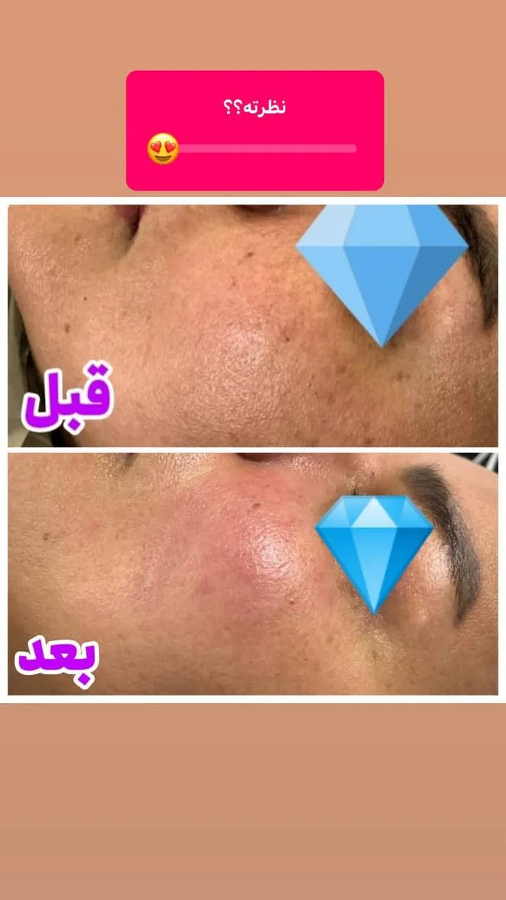 مریم اسکین‌کر - Image 3